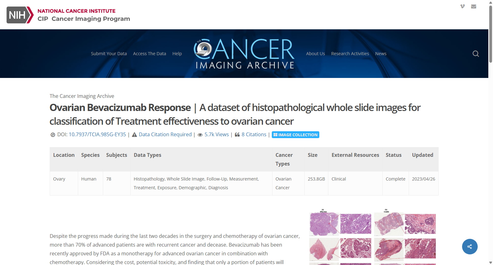 OVARIAN-BEVACIZUMAB-RESPONSE