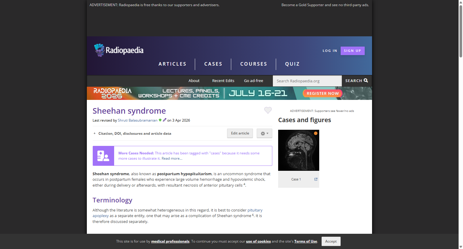 Sheehan Syndrome Pituitary MRI Reference Dataset