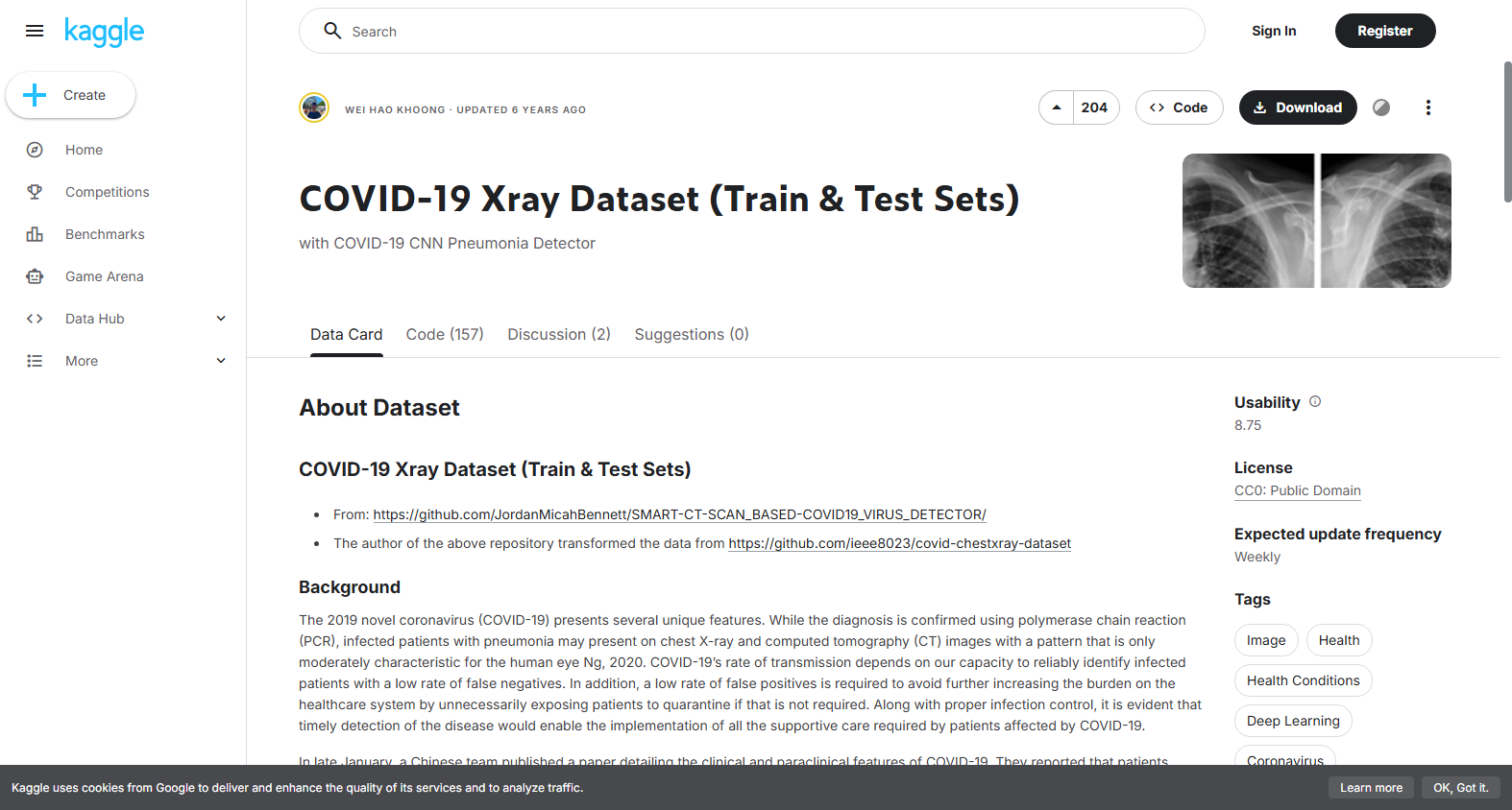 COVID-19 X-ray Dataset (Training and Test Sets)