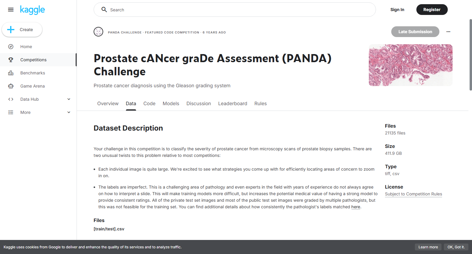 Prostate cANcer graDe Assessment (PANDA)
