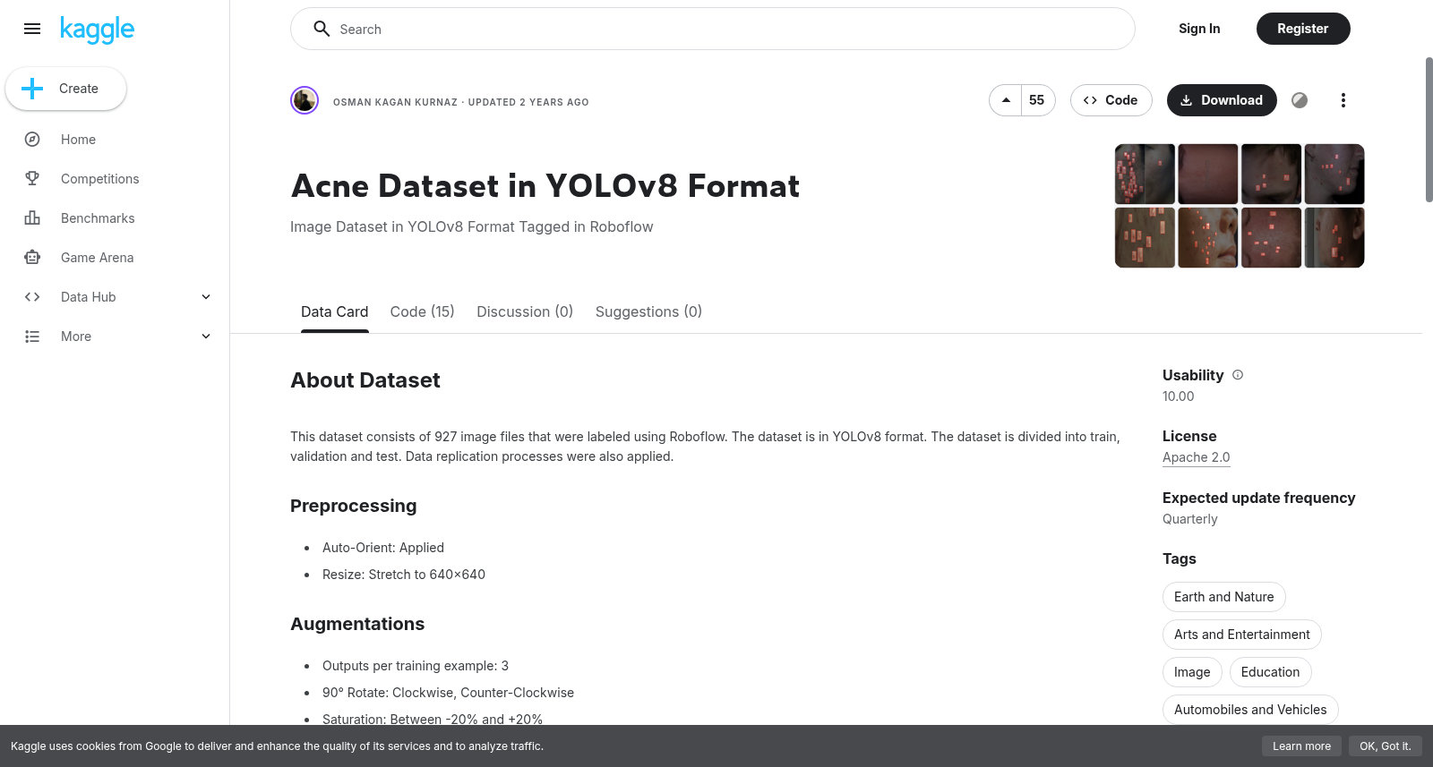 YOLOv8格式痤疮数据集