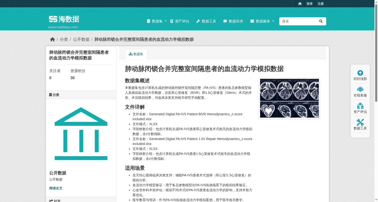 肺动脉闭锁合并完整室间隔患者的血流动力学模拟数据