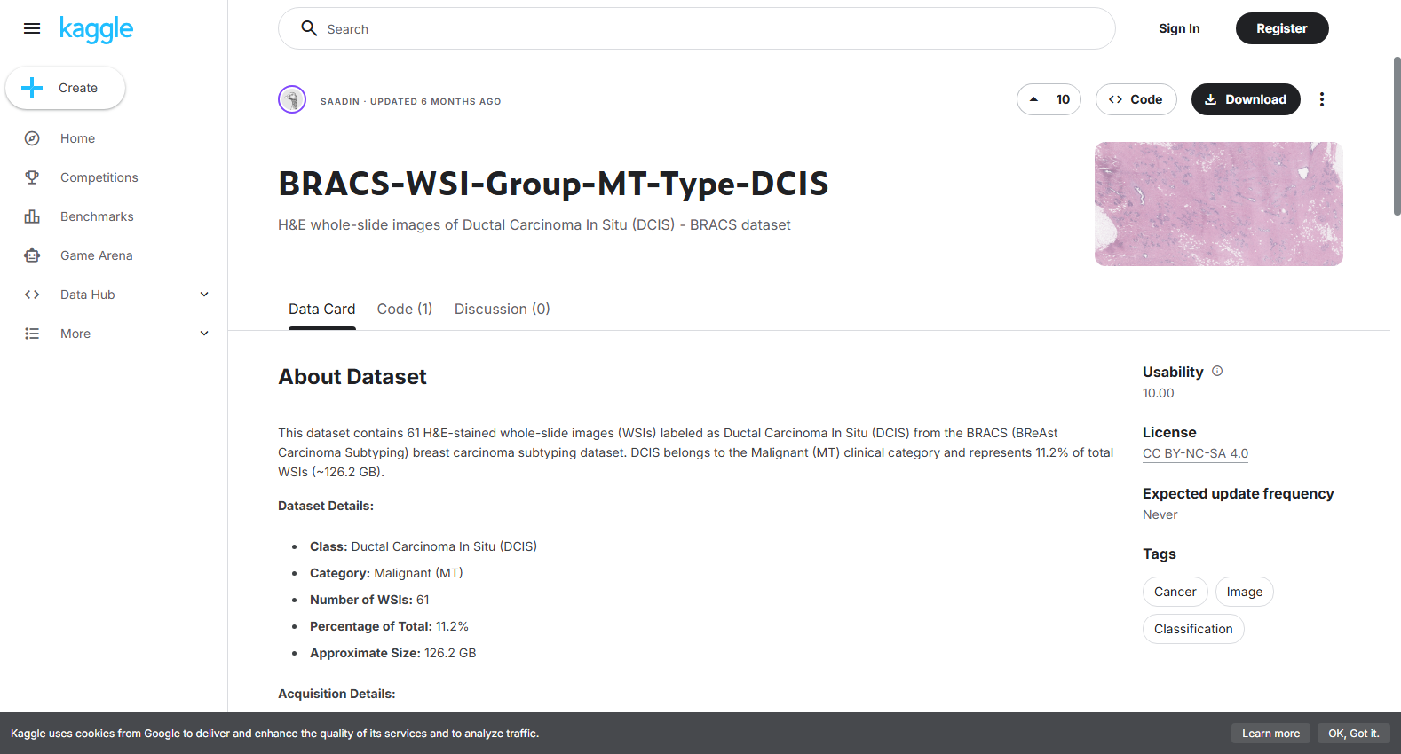 BRACS-WSI-Group-MT-Type-DCIS