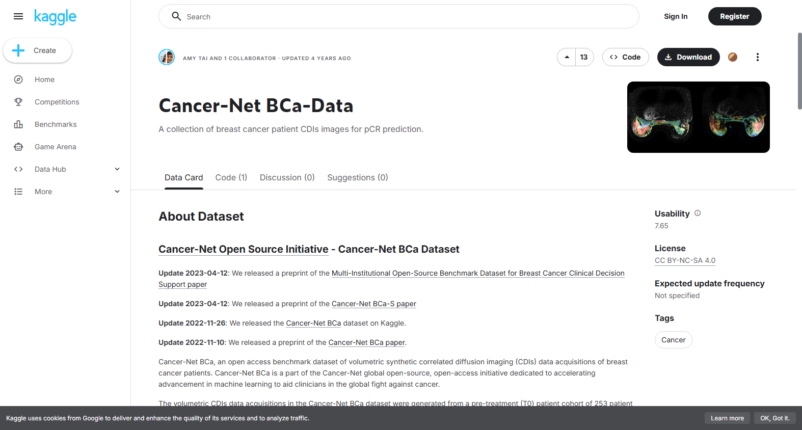 Breast Cancer Research Dataset