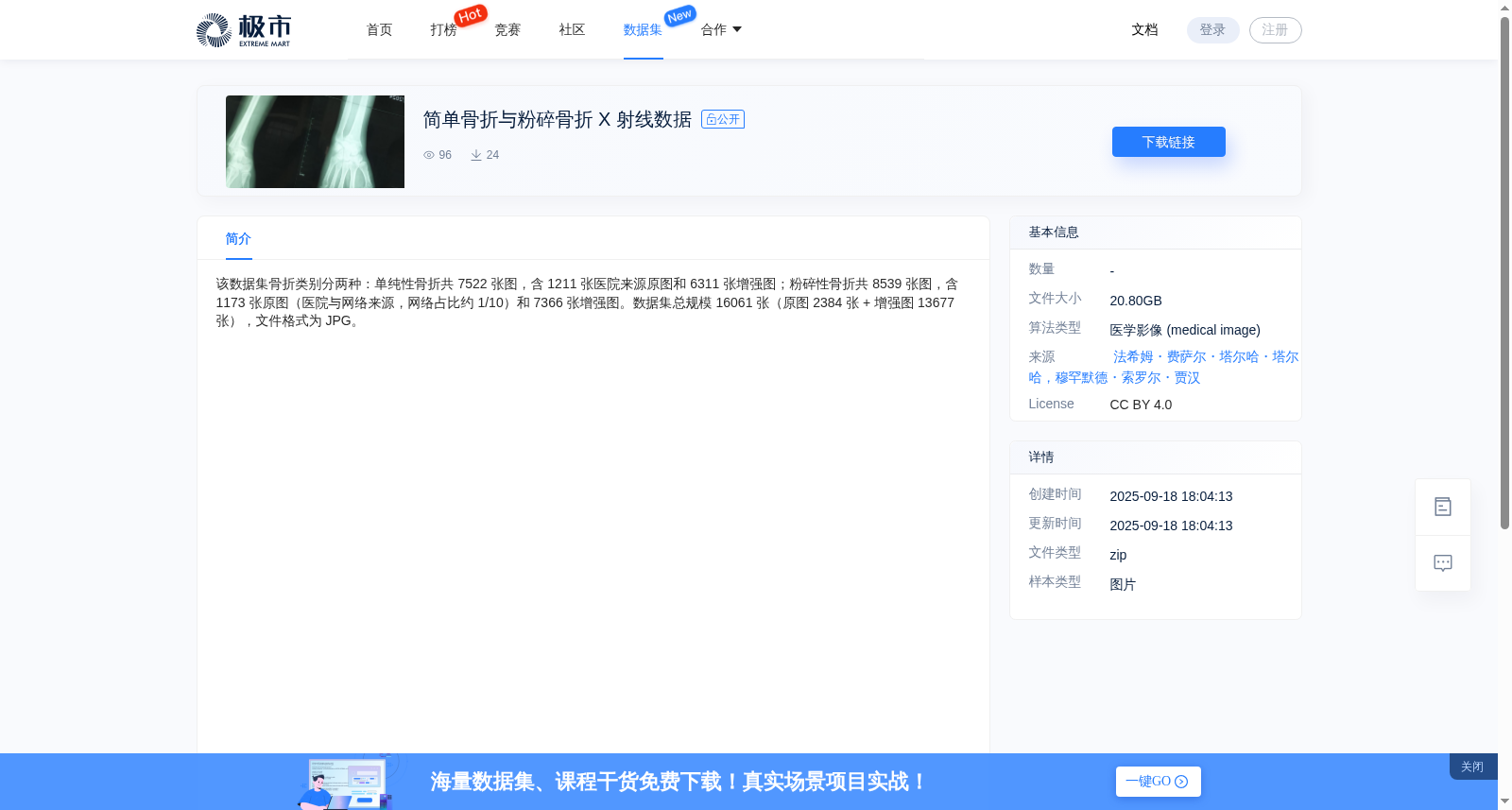 简单骨折与粉碎骨折 X 射线数据