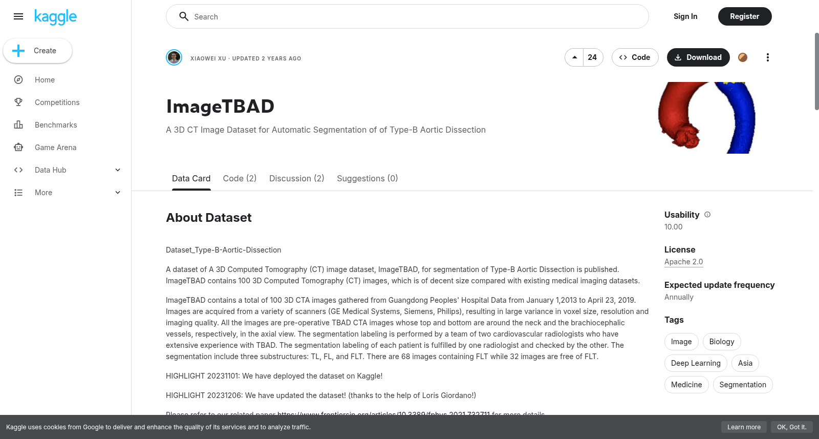 ImageTBAD