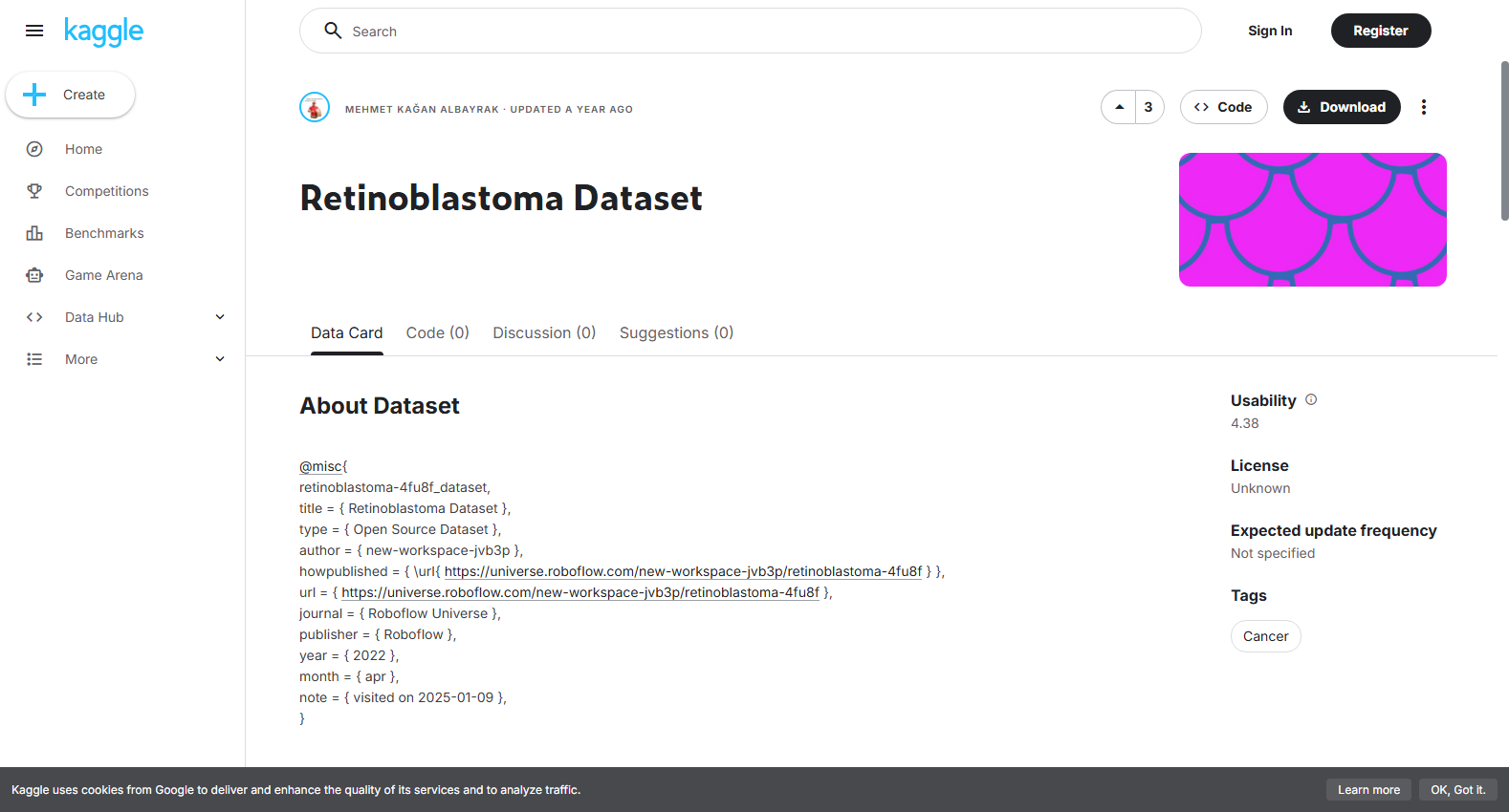 Retinoblastoma Dataset