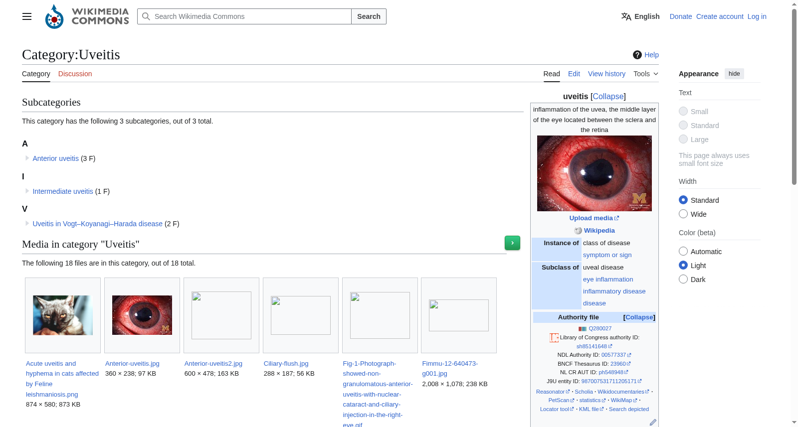 Wikimedia葡萄膜炎图像