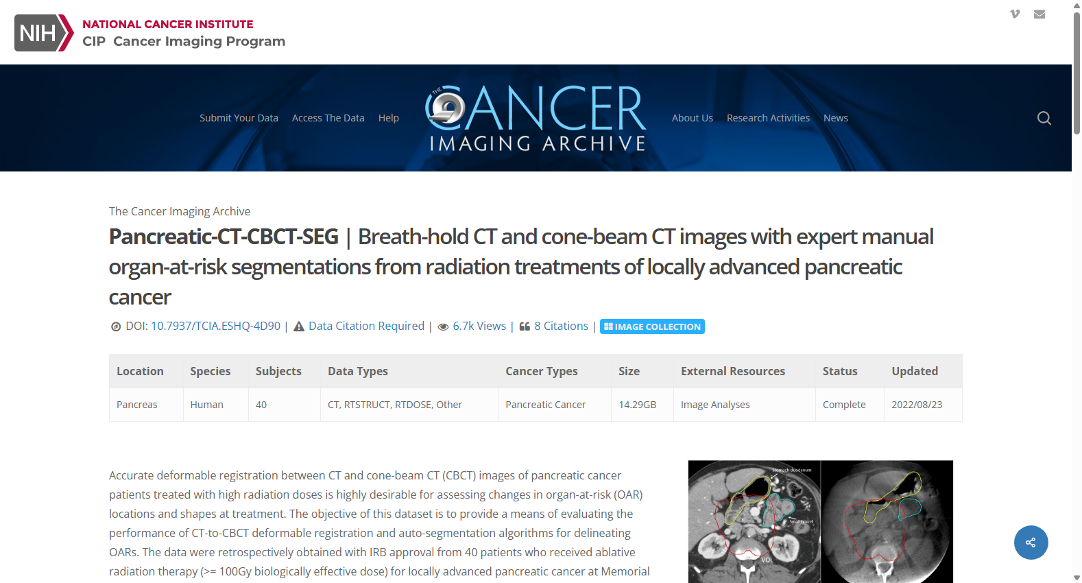 PANCREATIC-CT-CBCT-SEG