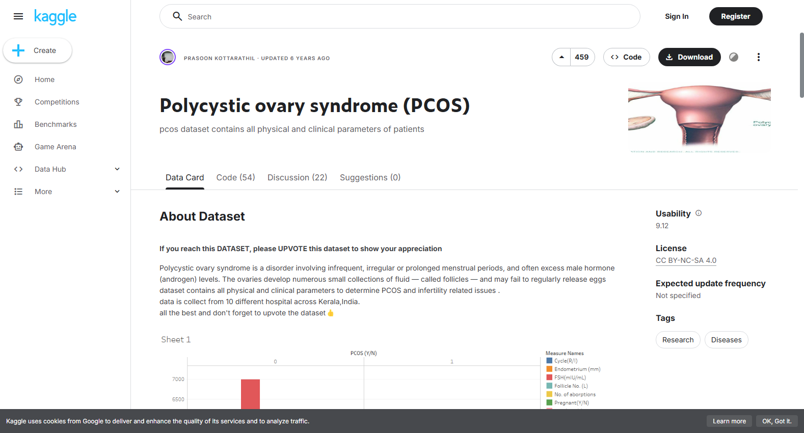 Polycystic Ovary Syndrome (PCOS)
