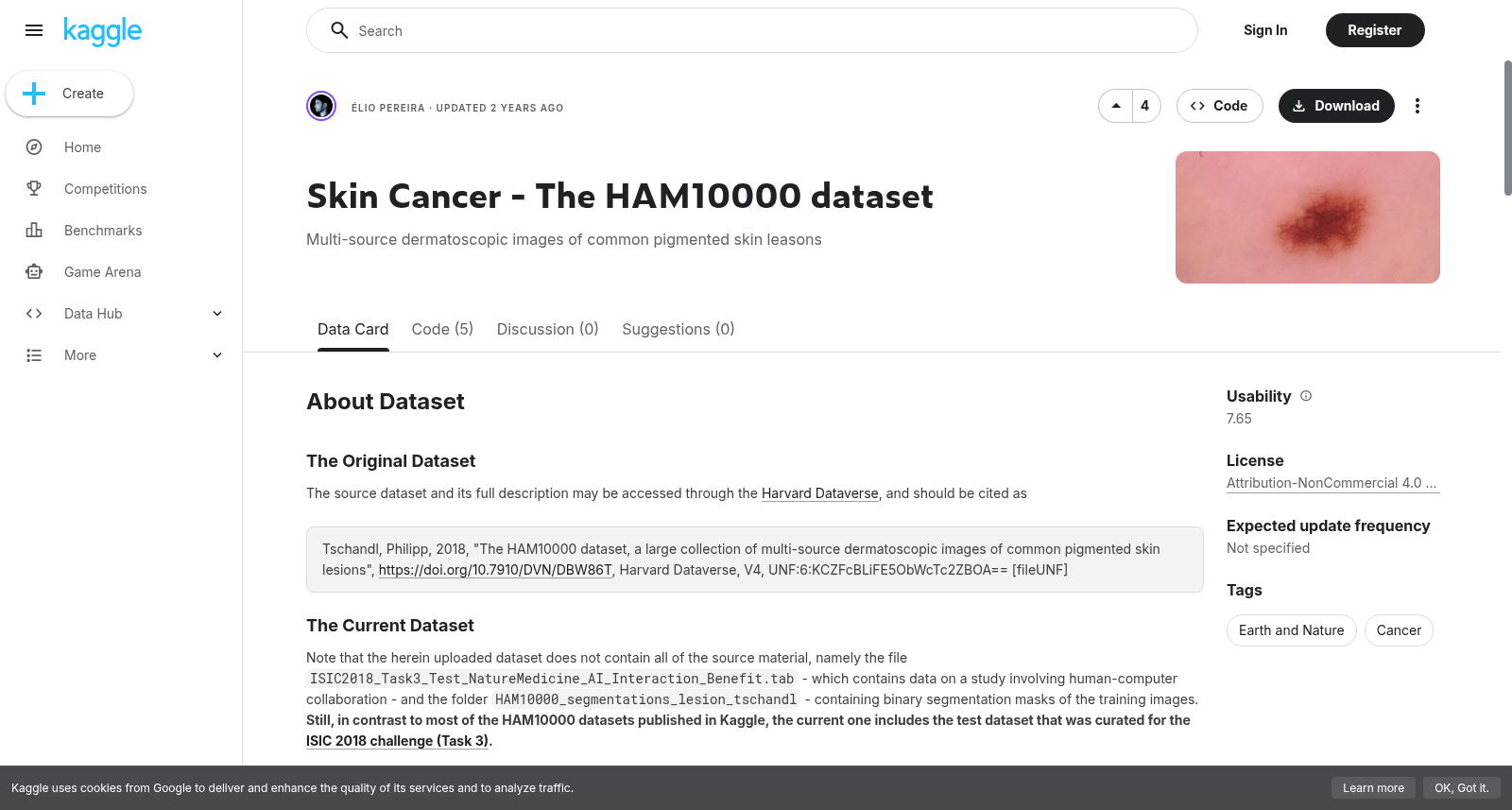 皮肤癌 - HAM10000 数据集