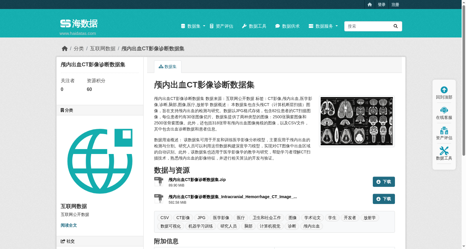 颅内出血CT影像诊断数据集