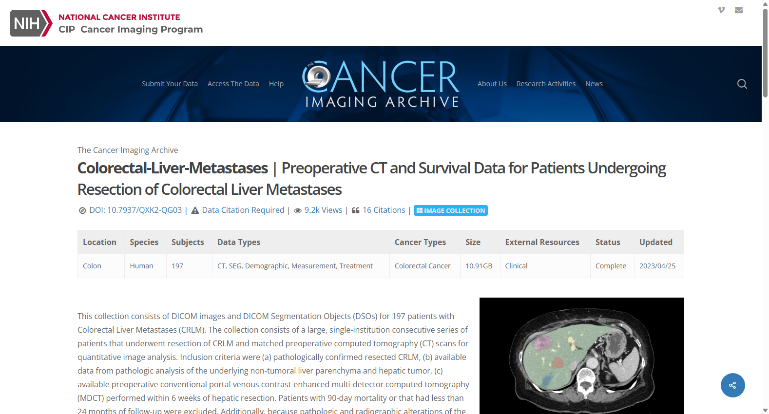 COLORECTAL-LIVER-METASTASES
