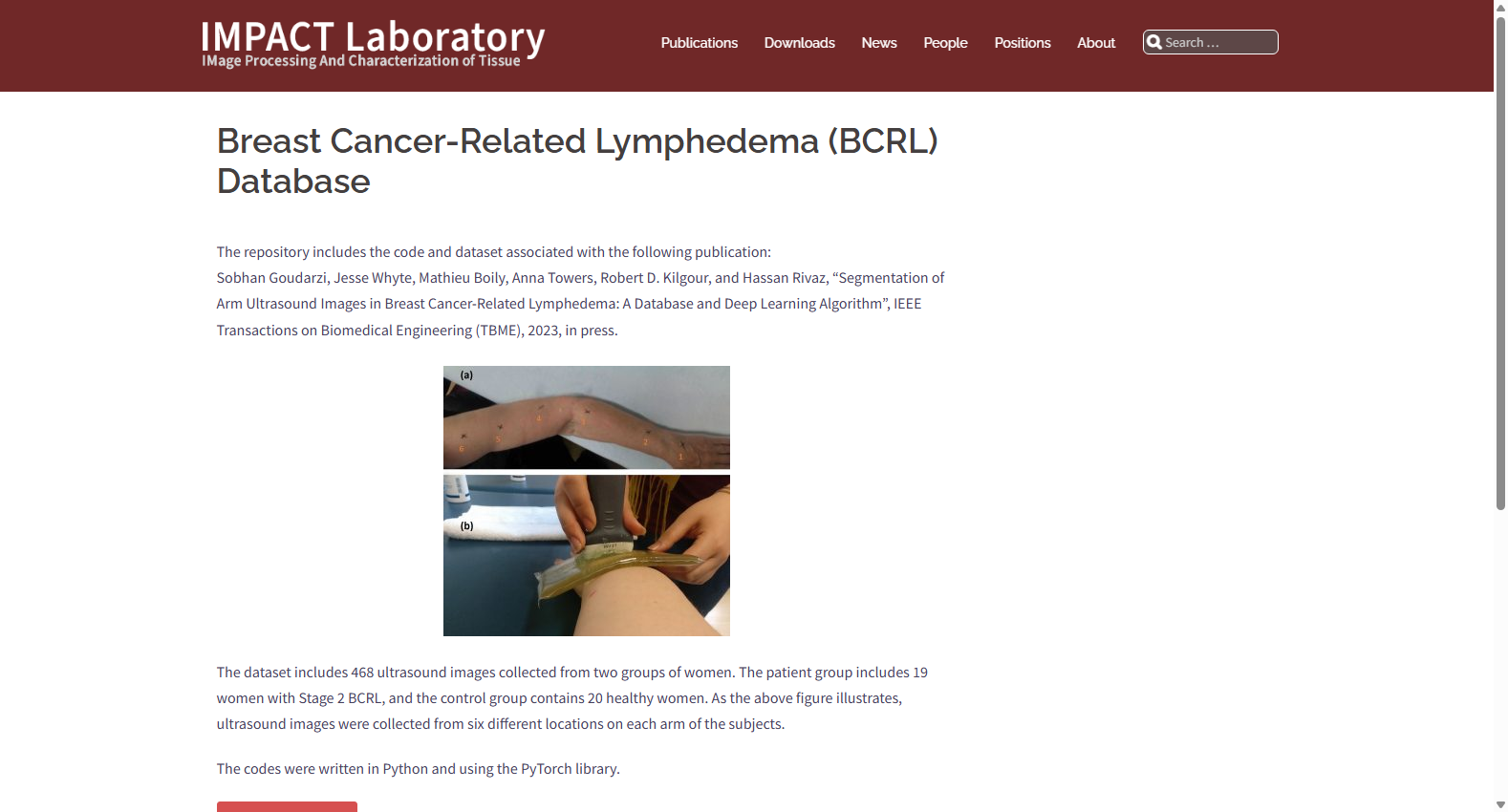 Breast Cancer-Related Lymphedema Database