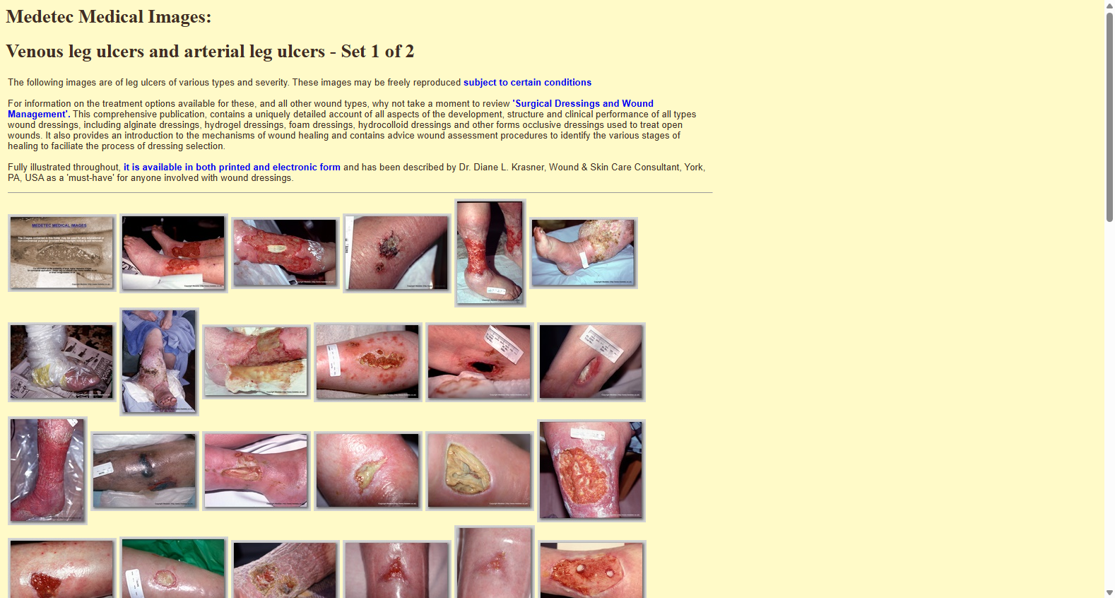 Medetec Leg Ulcer Images