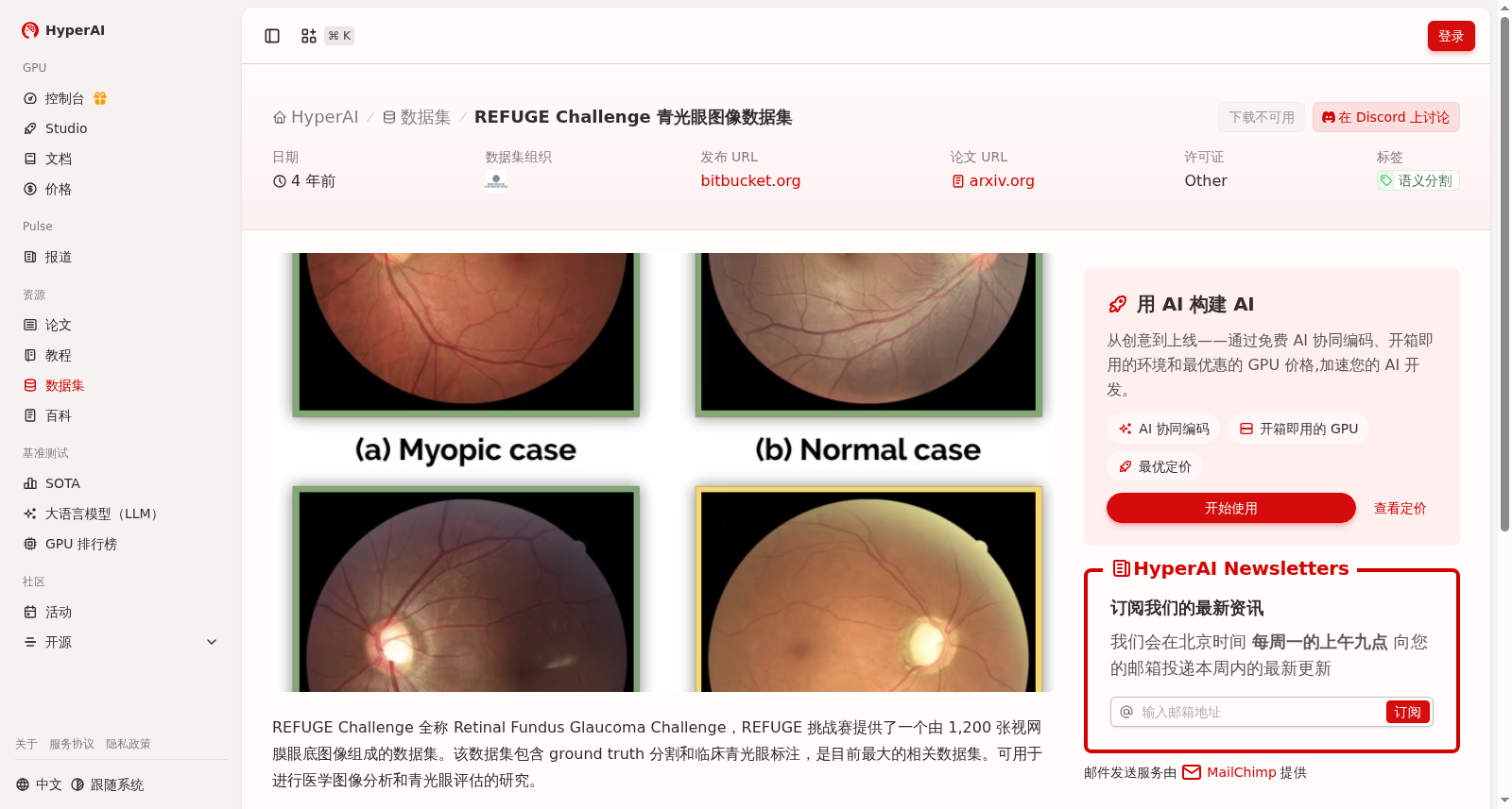 REFUGE Challenge 青光眼图像数据集