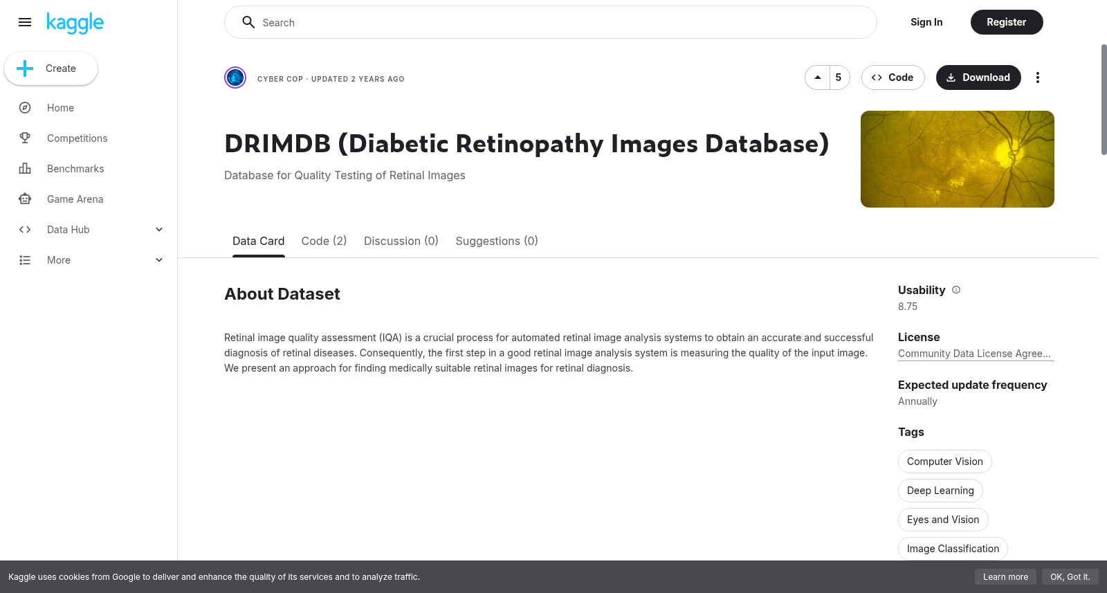 DRIMDB（糖尿病性视网膜病变图像数据库）