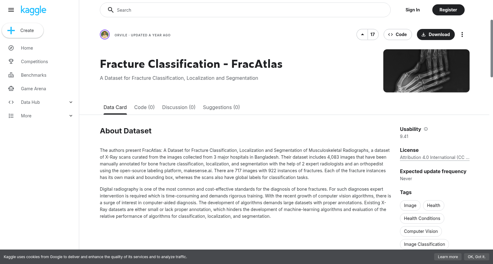 FracAtlas骨折分类数据