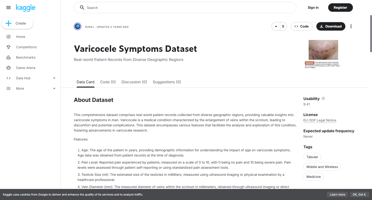 Varicocele Symptoms Dataset