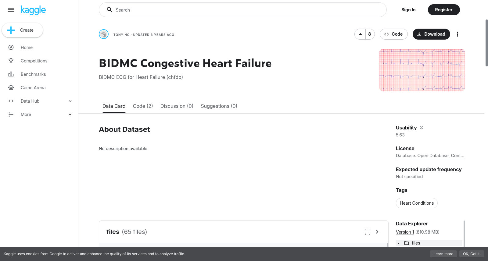 BIDMC充血性心力衰竭数据集